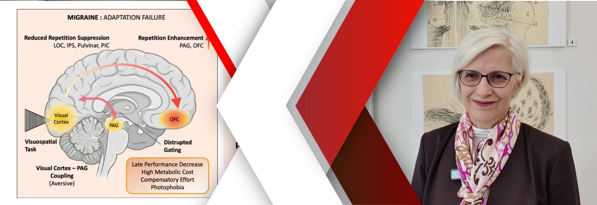 NÖROM açıkladı: Migrenli beyin “önemsizi” ayıramıyor, ışık ve desenler ağrıyı tetikliyor